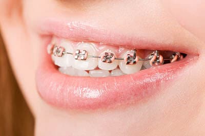 young girl learns why do orthodontists tighten braces