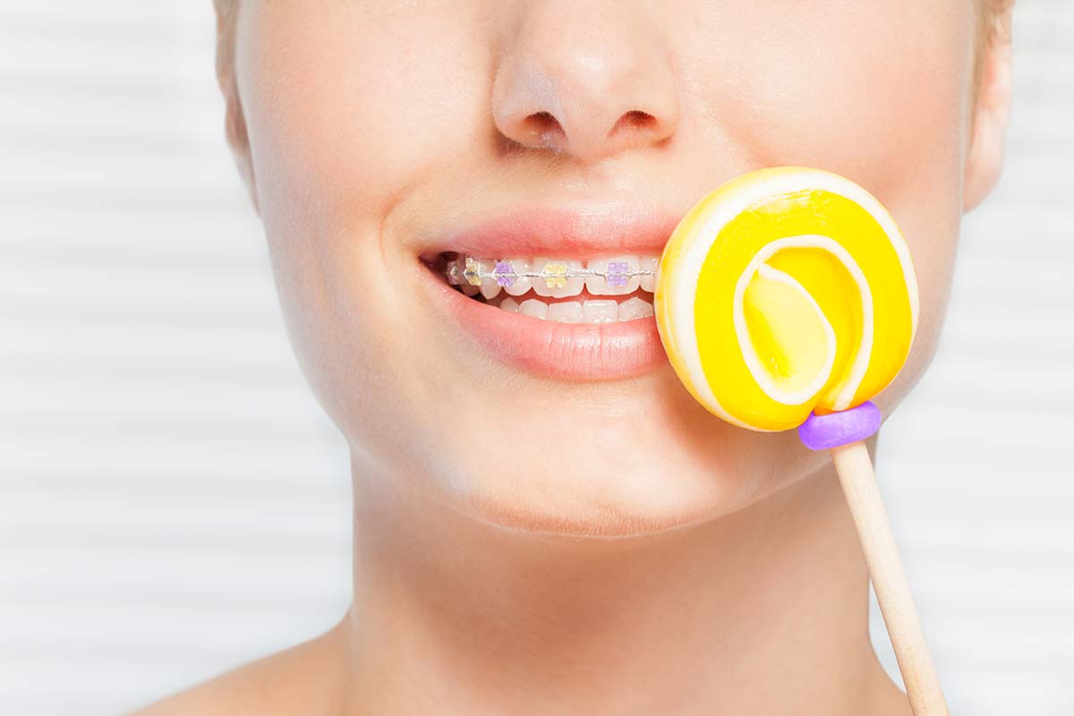 Worst Candies to Eat with Braces