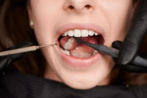 orthodontist in Cumming GA